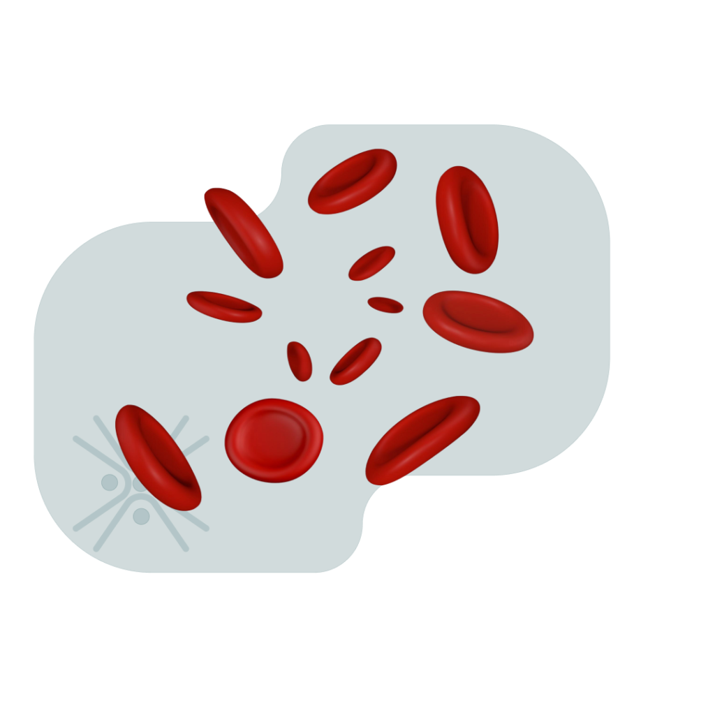 Hematology Sattva Homeocare - Best Homeopathic Clinic in Hyderabad